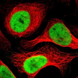 ADNP Antibody, Novus Biologicals 25 &mu;L; Unlabeled:Antibodies, Polyclonal